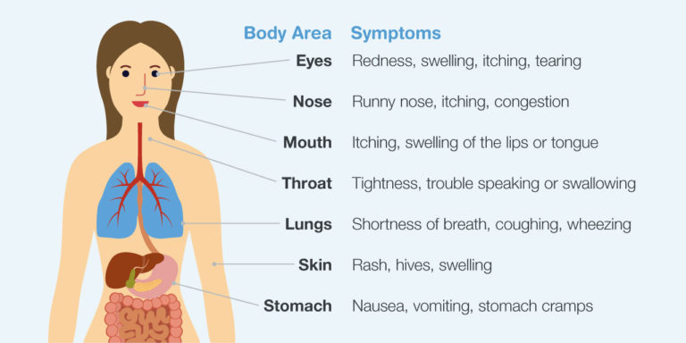 Allergies Food Wellness – Nutrimedical